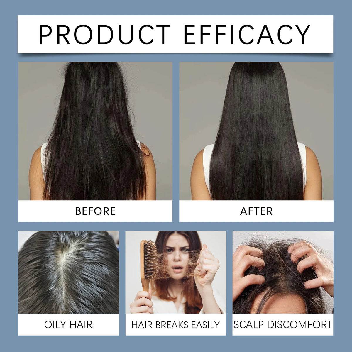 Rosemary Scalp Serum Roll-On – 25 mL | Xoratek